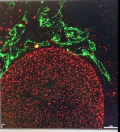 La microscopie à fluorescence super-résolutive ouvre de nouvelles voies de découverte